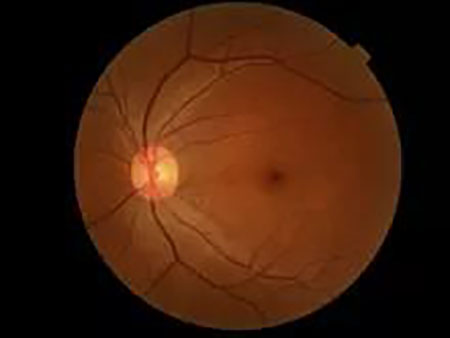 干细胞治疗,让失明重见光明-2.jpg